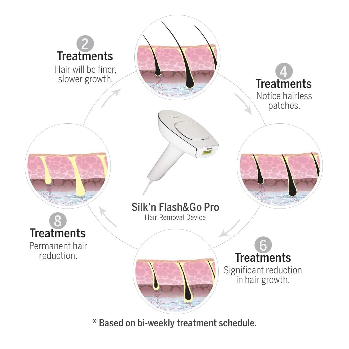 Silk'n HPL Hair Removal Device With Permanent Hair Reduction & Skin Safety Features