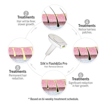 Silk'n HPL Hair Removal Device With Permanent Hair Reduction & Skin Safety Features